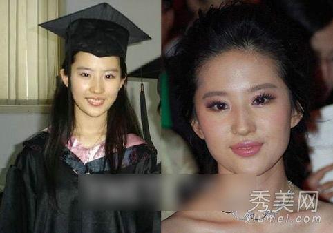 明星互相爆料整容视频,明星互爆整容视频,真实面目曝光引热议 第2张 明星互相爆料整容视频,明星互爆整容视频,真实面目曝光引热议 第2张